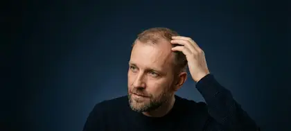 Nadmierne wypadanie włosów